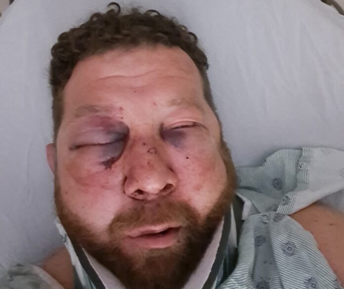 Illinois driver’s company launches fundraiser following violent truck stop assault
